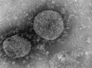 Una nuova epidemia: i Coronavirus di Wuhan
