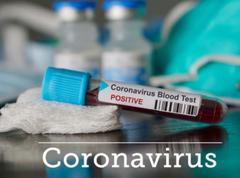 News Covid-19: 132 contagi in Italia