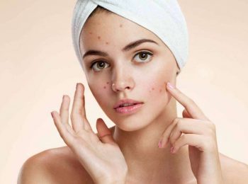 Come trattare le pelli impure tendenti ad acne?