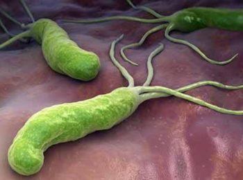 STOMACO ED HELICOBACTER PYLORI: UNA RELAZIONE COMPLICATA