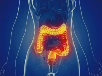 LE IBD: DAL MORBO DI CROHN ALLA COLITE ULCEROSA 