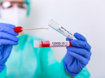 Test diagnostici e COVID-19: facciamo chiarezza